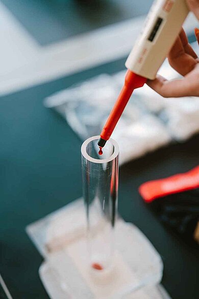 Pipette mit Bluttropfen © HTW Berlin_Alexander Rentsch